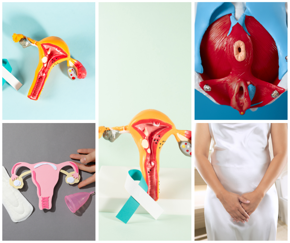 Chronic cervicitis vigina